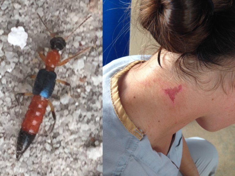 The Hot Zone: This Little Fly Can Inflict Some Serious Pain